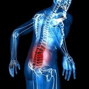 Osteocondrosi
