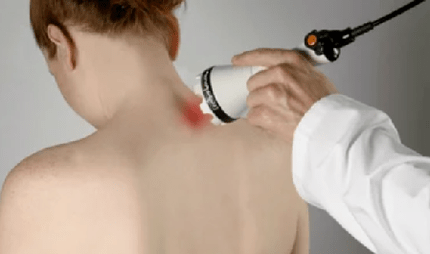 Trattamento dell'osteocondrosi cervicale con metodi fisioterapeutici