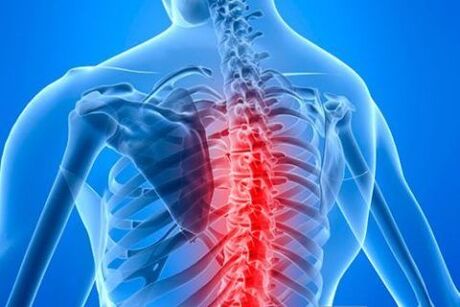 Osteocondosi toracica