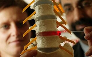 Sintomi e trattamento dell'osteocondosi della colonna vertebrale toracica