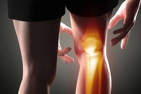 Distruzione dell'articolazione del ginocchio a causa dell'osteoartrosi