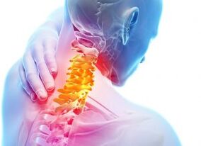 Dolore e fitte nella zona del collo nell'osteocondrosi di terzo grado